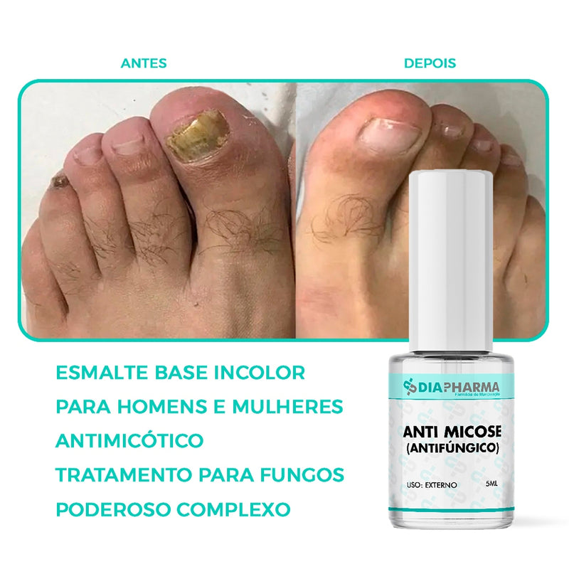 Kit 3 Esmalte Anti Micose